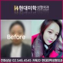 현대성형외과