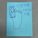 염주상정형외과의원 | 종자골염 치료 후기 : 체외충격파는 신이다