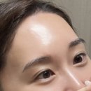 글리쥬