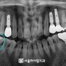 서울하이탑치과의원 이미지