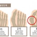 우무지 이미지