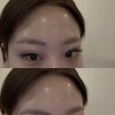 금수저 | 울산 남구 삼산 이태리 화장품, 피부관리샵 , 얼굴 윤곽관리 찐 후기 _ 금수저 에스테틱앤스파