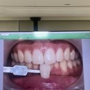 강남레옹치과의원 이미지