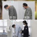 [온라인 들썩]&#39;난치병&#39; 이봉주, 굽은 등·지팡이 신세→수술 후 모습은 이미지