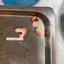 서울강남플란트치과의원 | 직산 치과) “천안 매복 사랑니 발치 과정 총정리! 붓기·통증·회복까지”+ 직원 동생 찐 후기