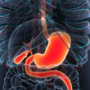 미라인여성의원 | 부산 동래 연산동 마운자로 효과 부작용 총정리