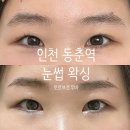 로로브로우바 | [인천 동춘역 왁싱] 눈썹 왁싱 후기 '로로브로우바'