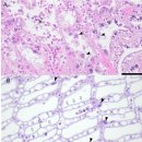 태평양맛조개 Siliqua patula의 nuclear inclusion X(NIX) 이미지