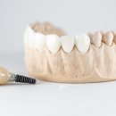 Ym 플란트 이미지