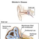 폴포이스안경 이미지