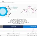 아이줌안경콘텍트 이미지