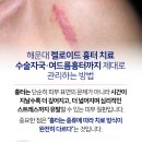 디엘성형외과의원 | 해운대 켈로이드 흉터 치료, 수술자국·여드름흉터까지 제대로 관리하는 방법