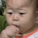 수정-10 | 비바헬멧 수정 후기, 피부 트러블 때문에 10일 만에 재방문한 이유