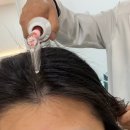 닥터모아젠 두피탈모관리센터 부산본점 | 부산 연산동 두피관리 닥터모아젠 두피탈모관리센터 퓨리파잉케어 후기
