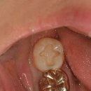 광안치과기공소 이미지