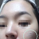 크린피부과 이미지