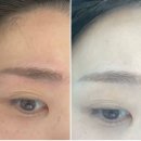 미작스튜디오 | 안산고잔동눈썹문신제거 :미작뷰티 시흥점 : 통증없는눈썹문신제거