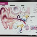 부천연세보청기 이미지