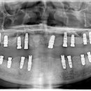 남양치과기공소 이미지