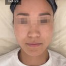 오로시에스테틱 | 부산 용호동 피부관리 w스퀘어 올가드림뷰티에서 모공디톡스 후기