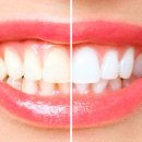 청담플란트치과의원 이미지