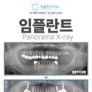 림플란트치과의원 네이버블로그