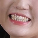 아트부부치과의원 네이버블로그