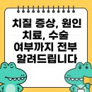 탄금호순환자전거길 2L | 치질 증상, 원인, 치료, 수술 여부까지 전부 알려드립니다
