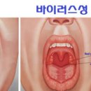 목감기 내과 이비인후과 진료 과목 감기 내과 이비인후과 차이 이미지