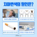연세웰치과 이미지