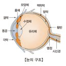 노년기 질환 - 녹내장 이미지