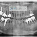 이근치과 네이버블로그