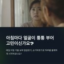 사진 전/후로 입증된 붓기 제거템, 슬림핏 호박스틱 후기