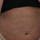 (주)현대그린푸드 대구그랜드호텔 | 대구 다이어트[케어포랩]에서 1:1관리받은 후기!!