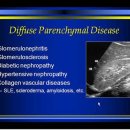 diffuse parenchymal diseas of kidney 이미지