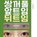 지오성형외과