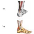 에이앤프리햅 이미지