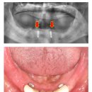 STL치과기공소 이미지