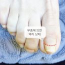 타임네일 페디베네 이미지