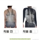 고려보조기 이미지