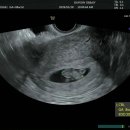 엠제이시스템 | 임신 확인 후 할 일 정리 #2 (산후조리원 예약 - 엠제이산후조리원)