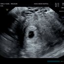 하나행운켄넬 | [임신기록]6주~9주_ 양산보건소 산전검사 임산부초기검사 임산부등록 축하선물/입덧증상