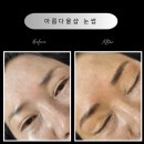 원도안로-19 이미지