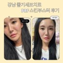 아우라지장 | 강남 줄기세포치료 PRF 스킨부스터 후기