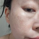 지혜뷰티# | 흑진주 미스트 추천 피부장벽 클렌징 오키뷰티 솔직후기