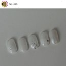 누스네일