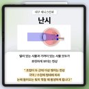 범어동 안과 / 난시, 근시, 원시의 차이점은 항상 헷갈려요