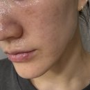 ㈜비제이메디칼디바이스 | [내돈내산] AHOHWA “아오와 워터/멀티 크림”으로 피부 장벽 되살리기 찐후기