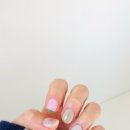 아이오네일 이미지