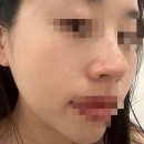 진테라피에스테틱 이미지